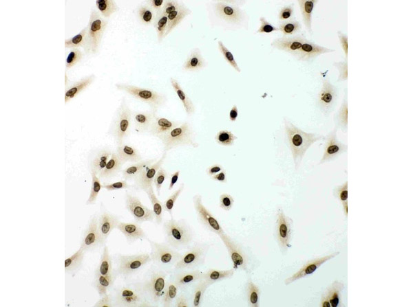 Immunocytochemistry analysis of Lamin B1